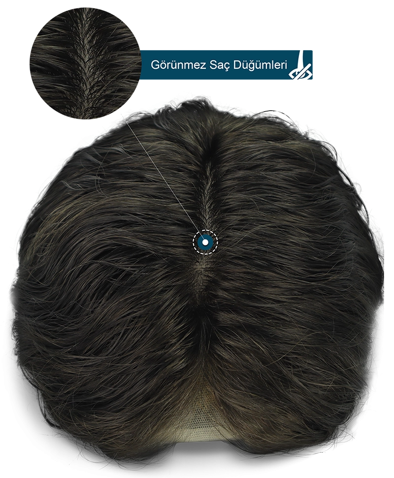 Re-Touch Men's Hair System Base